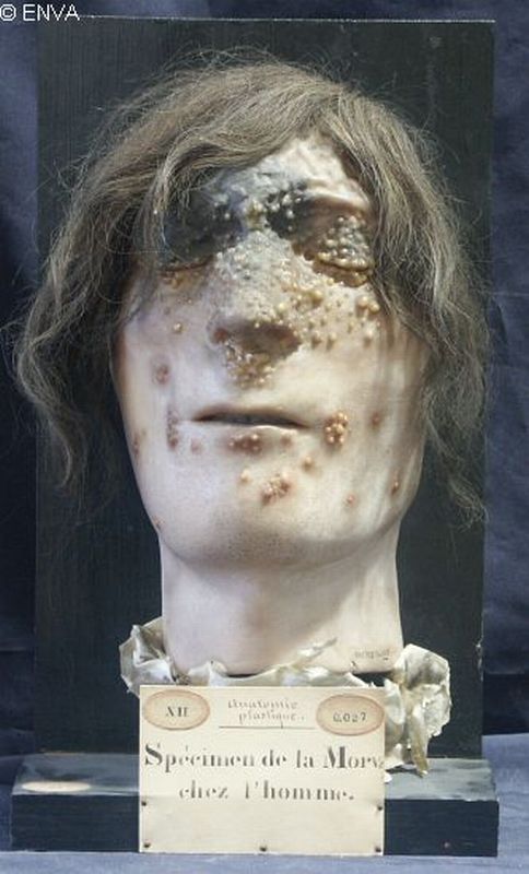 Masque mortuaire d'un étudiant vétérinaire, décédé en 1836 après l'avoir contractée en se coupant lors d'une autopsie de cheval — Musée Fragonard EnvA